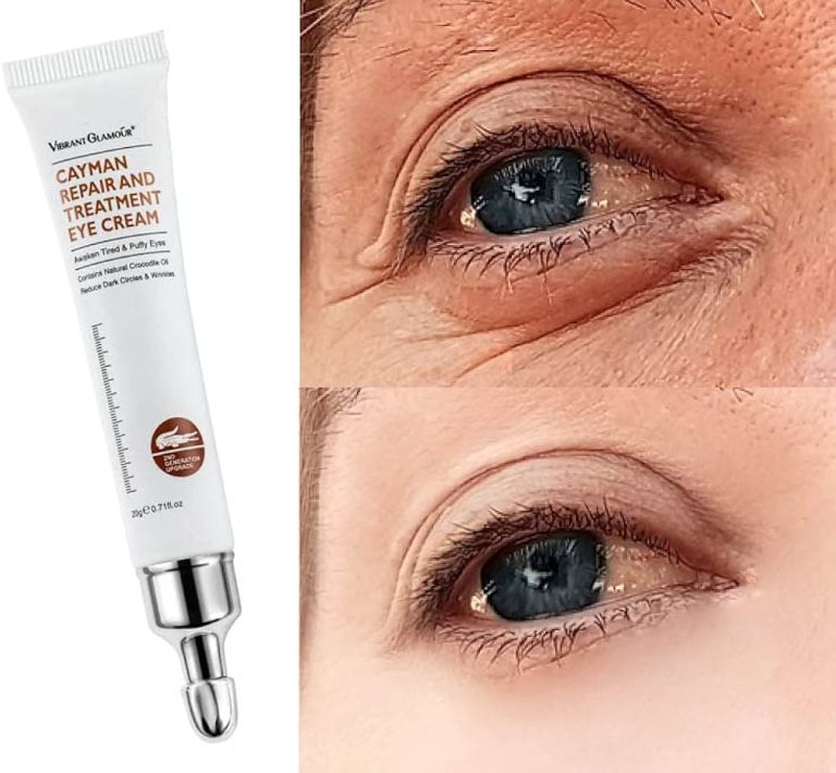 9 Best Under Eye Creams: Eliminate Dark Circles, Puffiness & Fine Lines