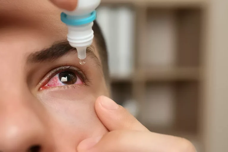 9 Best Eye Drops for Dry Eyes: Top Picks for Comfort and Relief